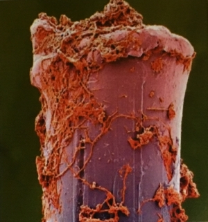 歯ブラシの先につく雑菌の写真